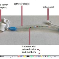 Tracheostomy education suction patient mucus patients medical use teach three things nurse machine prepare life will altering potentially permanent affect