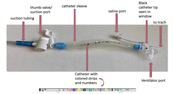 Tracheostomy education suction patient mucus patients medical use teach three things nurse machine prepare life will altering potentially permanent affect